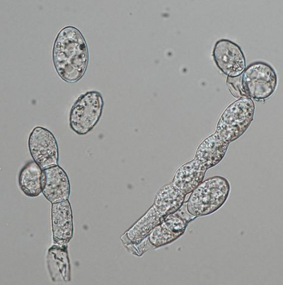 병원균(분생포자)