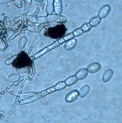 병원균(분생포자)