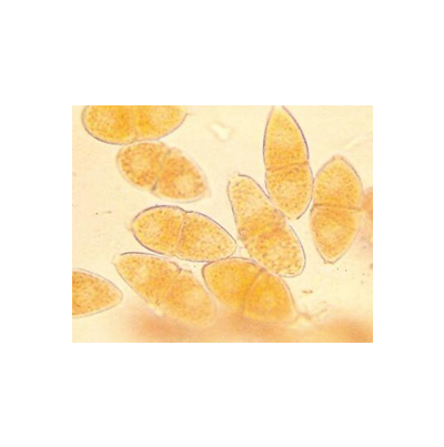 병원균(동포자)