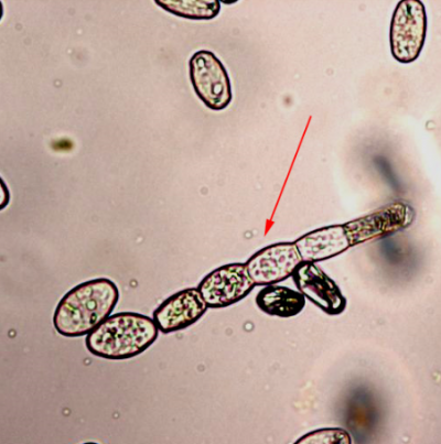 병원균(분생포자)