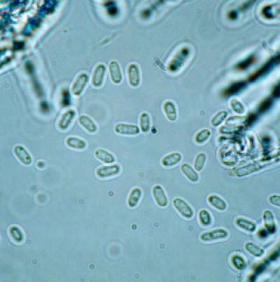 분생포자(투명포자)