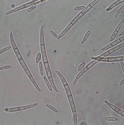 병원균 소형 및 대형분생포자(F. moniliforme)