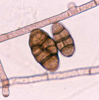 병원균(분생포자)