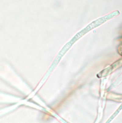 병원균(분생포자)