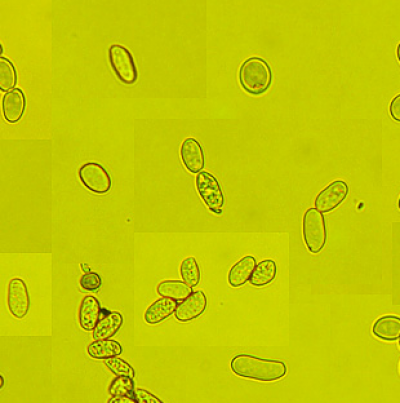 병원균(분생포자)