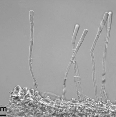 병원균(분생포자)