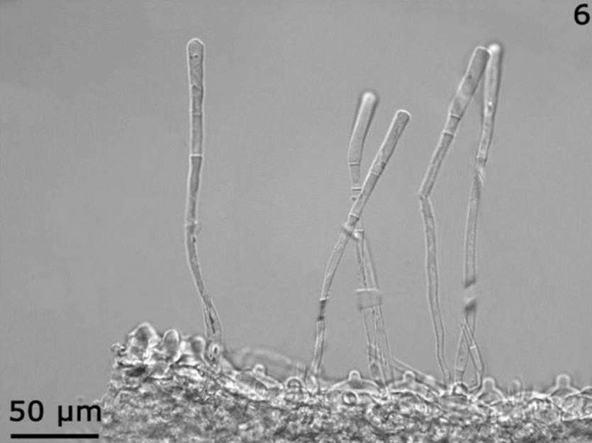 병원균(분생포자)