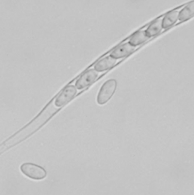 병원균(자낭포자)
