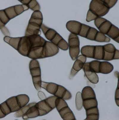 병원균(분생포자)