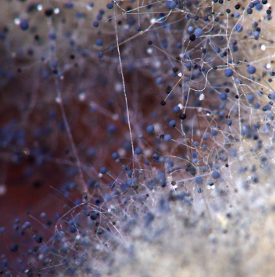 병원균(포자낭)