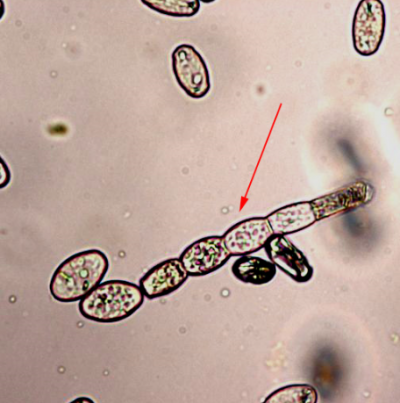 병원균(E. cichoracearum)