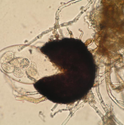 병원균(자낭과 자낭각)
