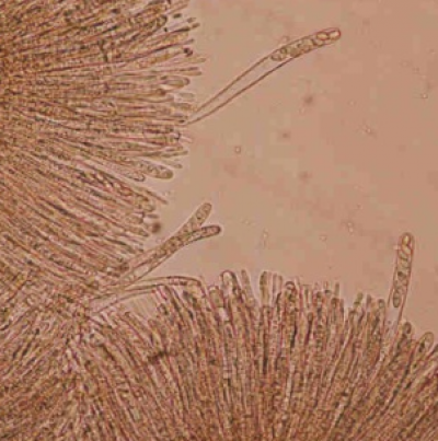 병원균(자낭 및 자낭포자)   