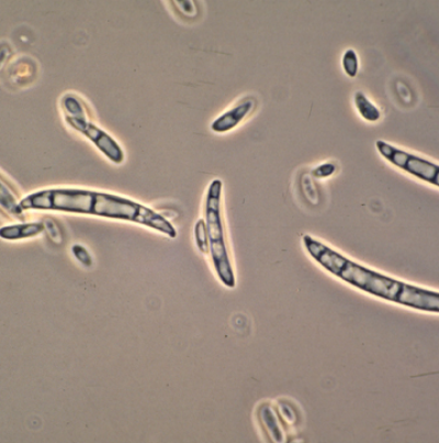 병원균(분생포자)
