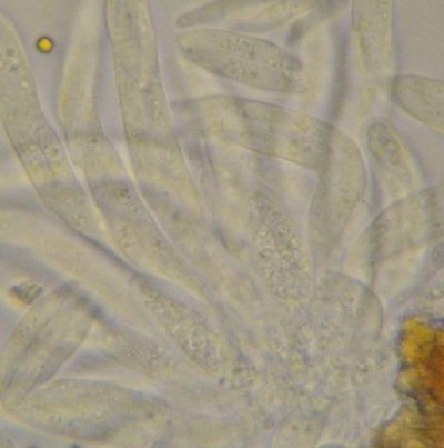 병원균(분생포자)