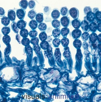 병원균(포자낭)