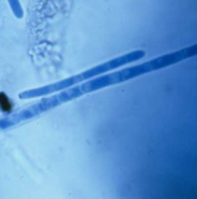 병원균(분생포자)