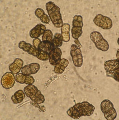 병원균(분생포자)