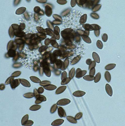 병원균(분생자경)