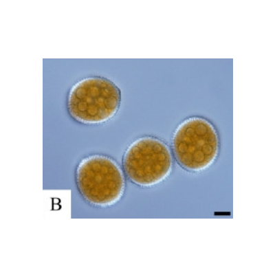 병원균(녹포자퇴, Scale bar=10㎛)