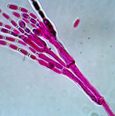 병원균(분생포자)