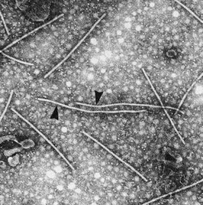 병원체 바이러스