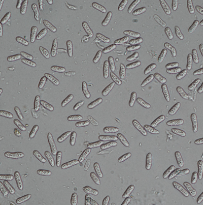 병원균(분생포자)