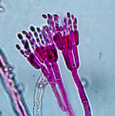 병원균(분생포자)