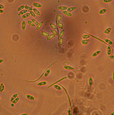   병포자(α, β포자)