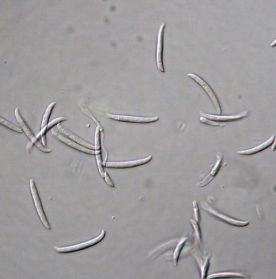 병원균(분생포자)