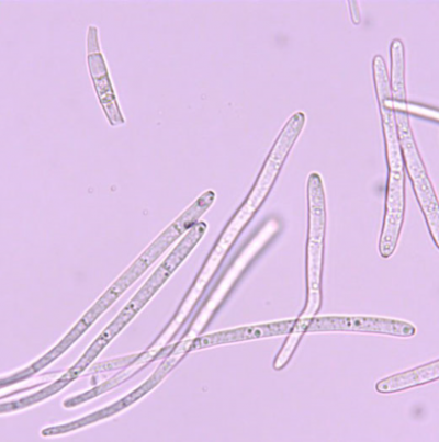 병원균(분생포자)