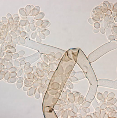 병원균(B. cinerea 분생자경과 분생포자) 