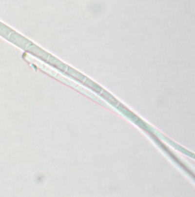 병원균(분생포자)