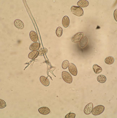 병원균(포자낭)