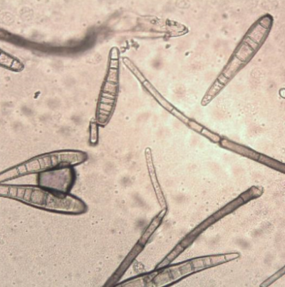 병원균(분생포자)