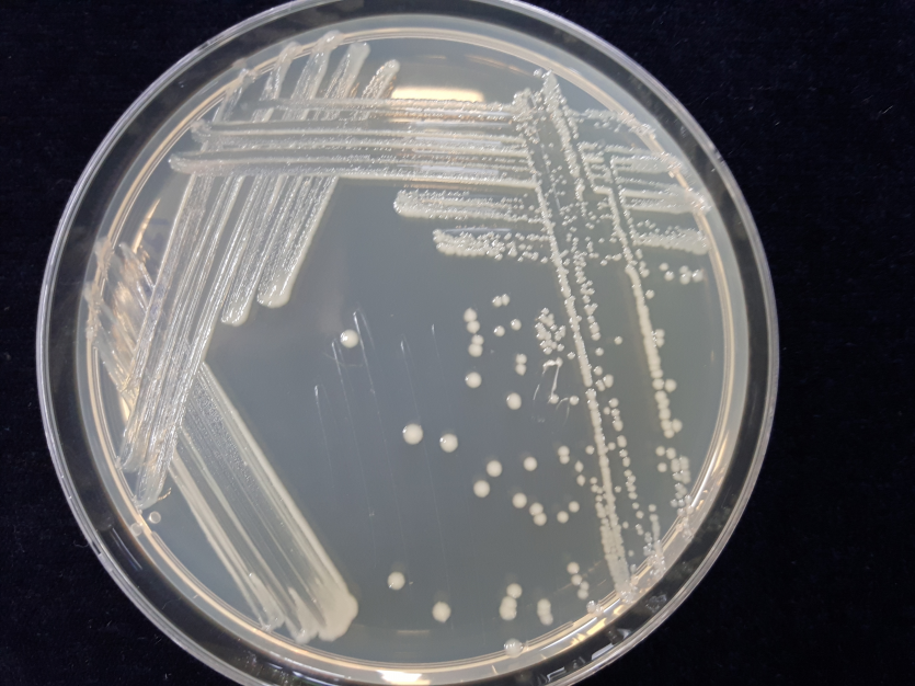 배지(TSA)에 형성된 병원균 Colony