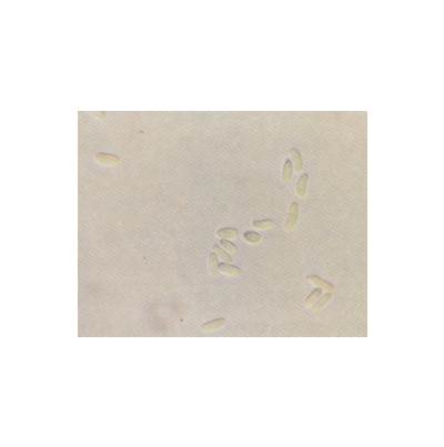 병원균(병포자)