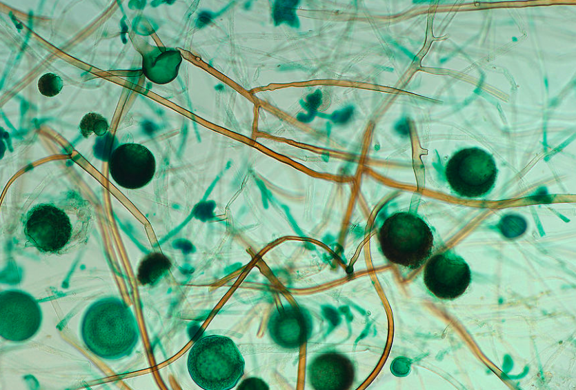 병원균(포자낭포자)