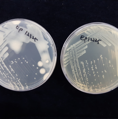배지 상의 균총(KB 배지(좌) 흘러내릴 정도의 콜로니, TSA 배지(우) 반투명 회백색 콜로니)