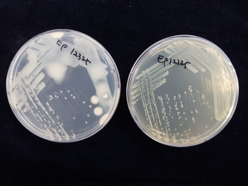 배지 상의 균총(KB 배지(좌) 흘러내릴 정도의 콜로니, TSA 배지(우) 반투명 회백색 콜로니)