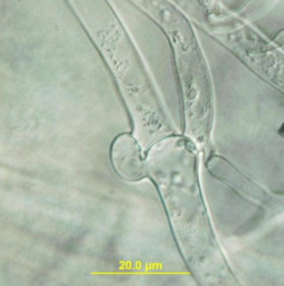 병원균(균사 접합 꺽쇠연결)