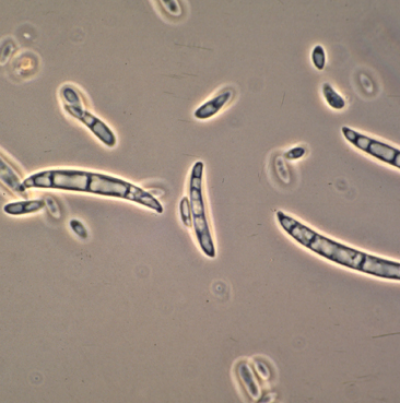 병원균(분생포자)