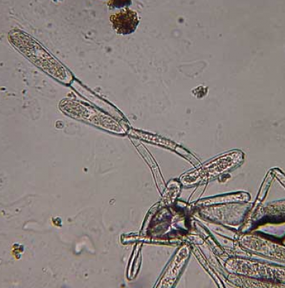 병원균(분생포자)