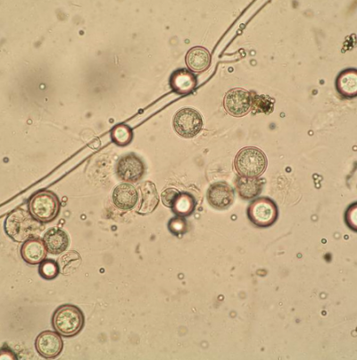 병원균(난포자)