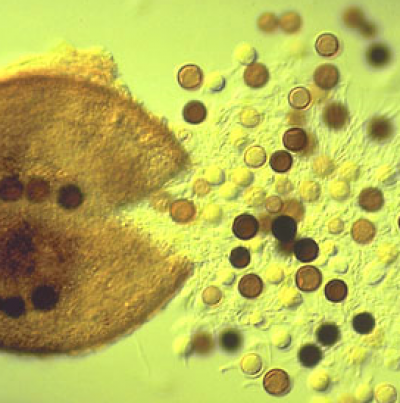 병원균(자낭 및 자낭포자)