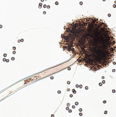 병원균(포자낭 및 포자)