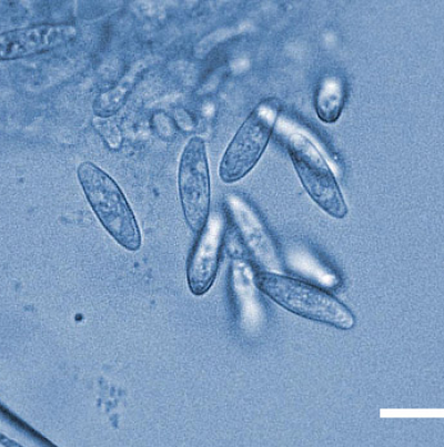 병원균(자낭포자)