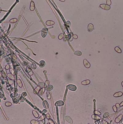 병원균(분생포자)