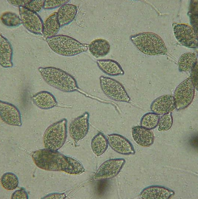 병원균(유주자낭)
