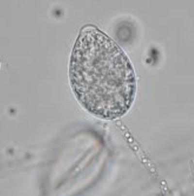 유주포자낭( P. citrophthora)